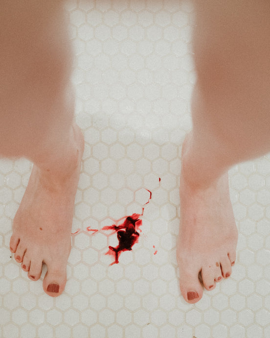Period Shame - why we have to stop the stigma