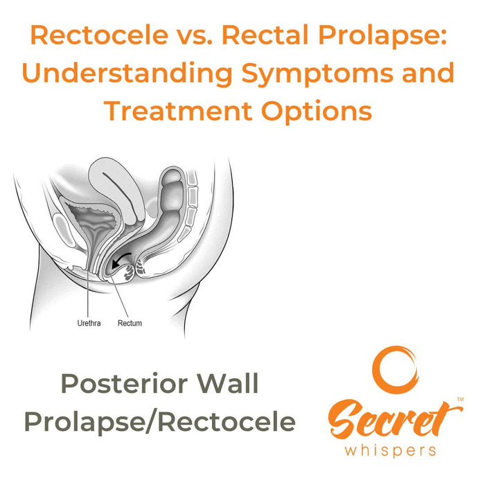 Rectocele vs. Rectal Prolapse: Understanding Symptoms and Treatment Options