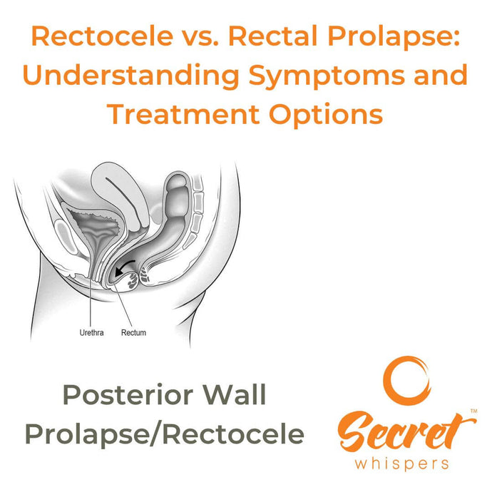 Rectocele vs. Rectal Prolapse: Understanding Symptoms and Treatment Options