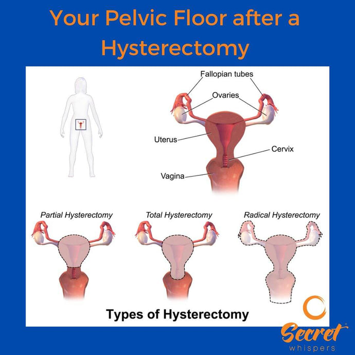 Your Pelvic Floor after a Hysterectomy